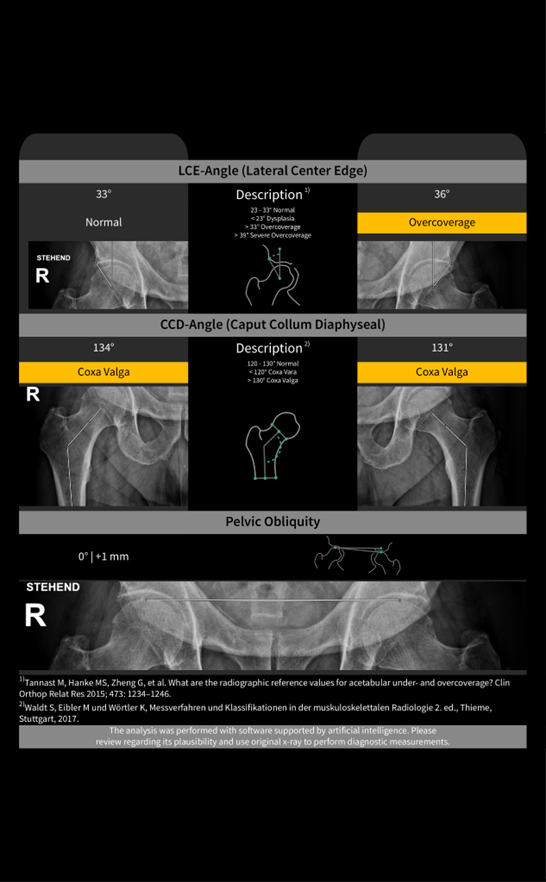 Hip Positioning Assistant – IB Lab HIPPO
