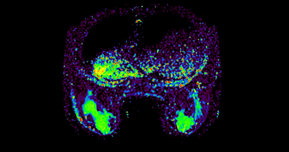 DWI Processing | IB Diffusion