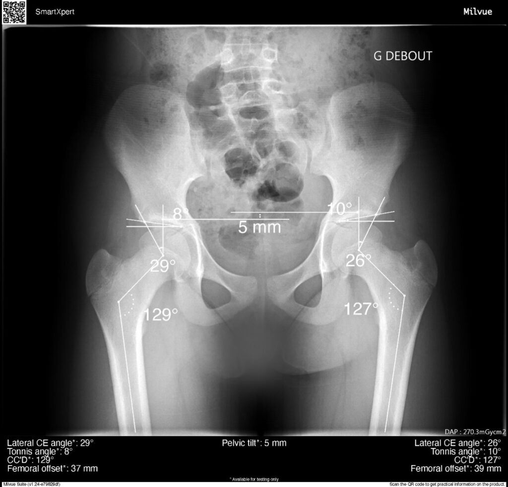 MSK Measurements | SmartXpert