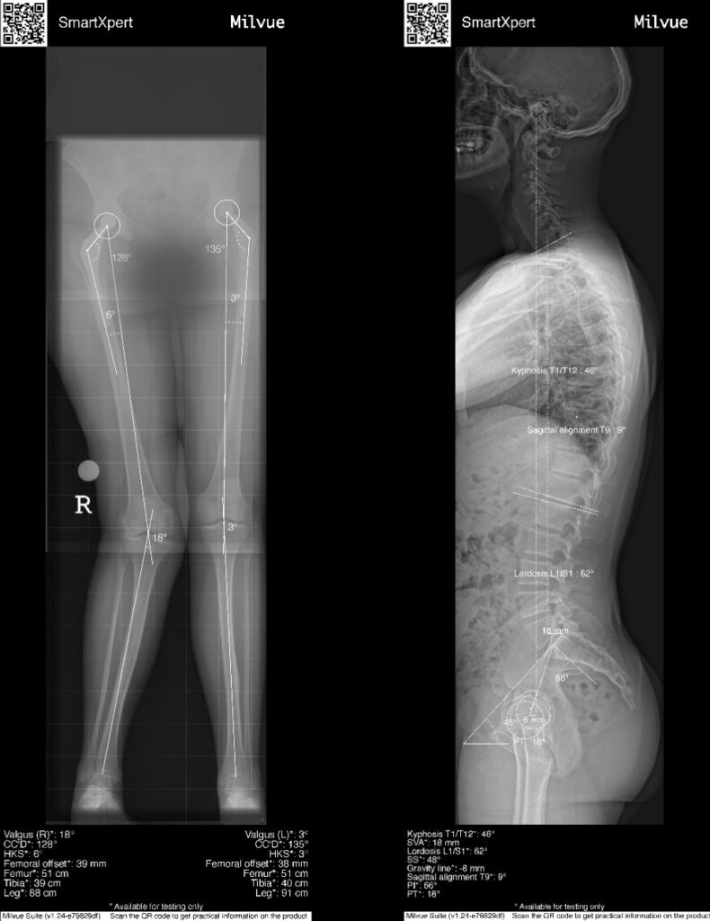 MSK Measurements | SmartXpert